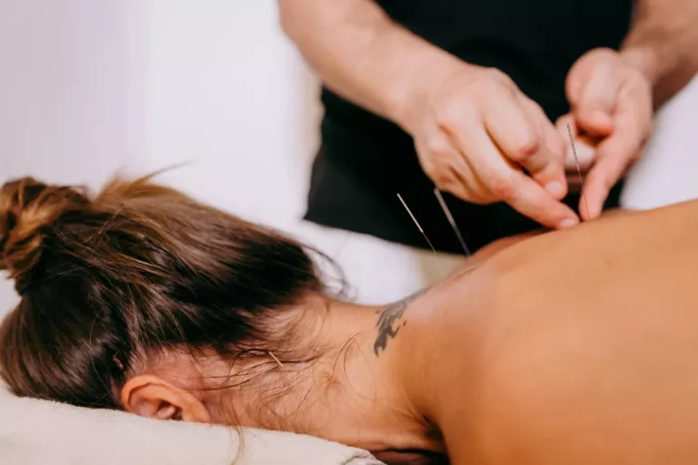 Tratament Acupunctura Ramira
